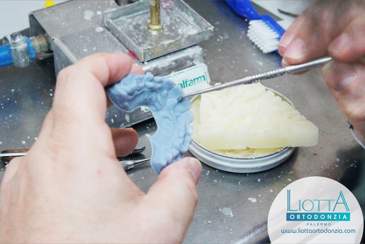 Laboratorio Ortodontico Liotta - Palermo