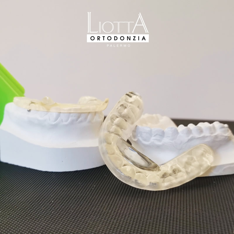 laboratorio ortodontico Liotta produce Bite gnatologici