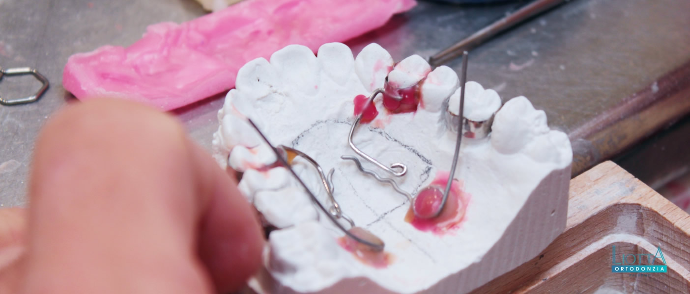 Liotta è un laboratorio ortodontico a Palermo altamente specializzato in ortodonzia, per adulti e bambini.