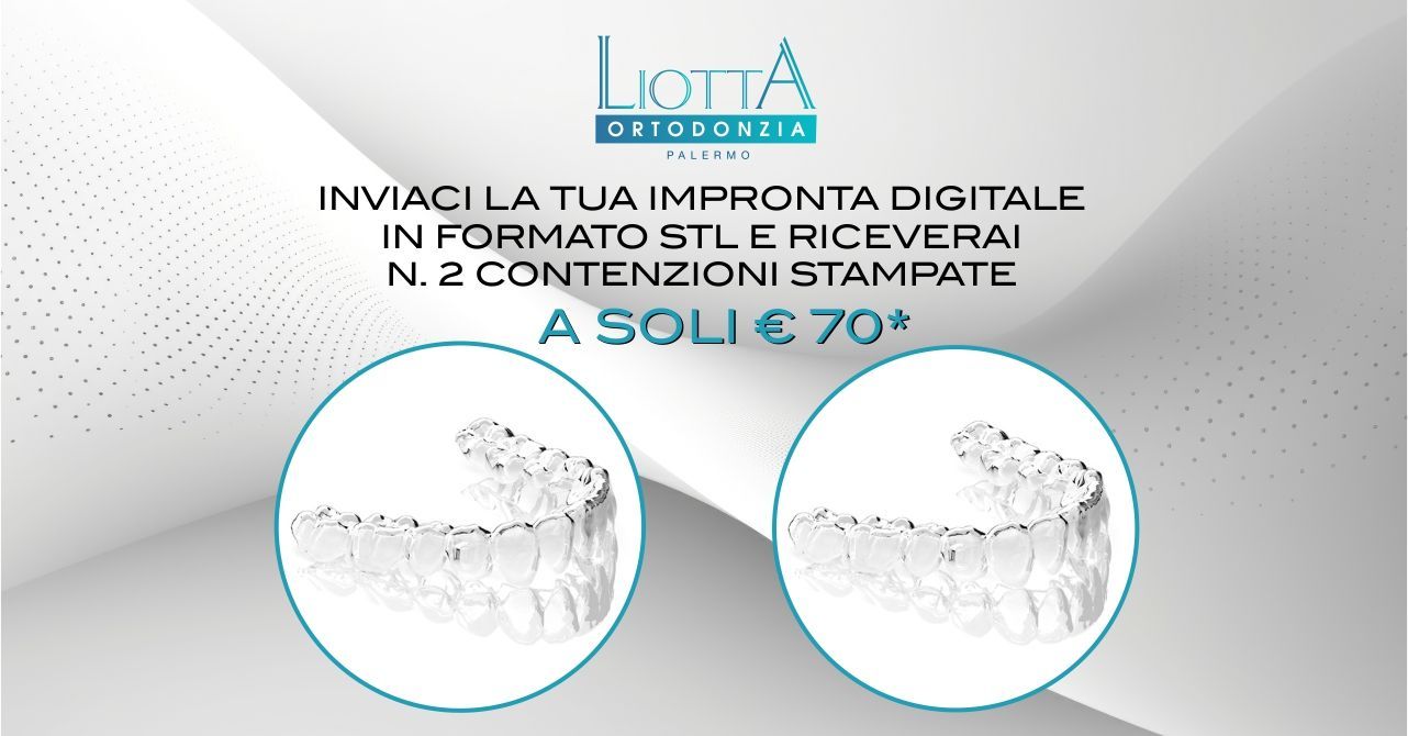 Promozione laboratorio ortodontico Liotta Palermo: 10 Coppie di contenzioni stampate