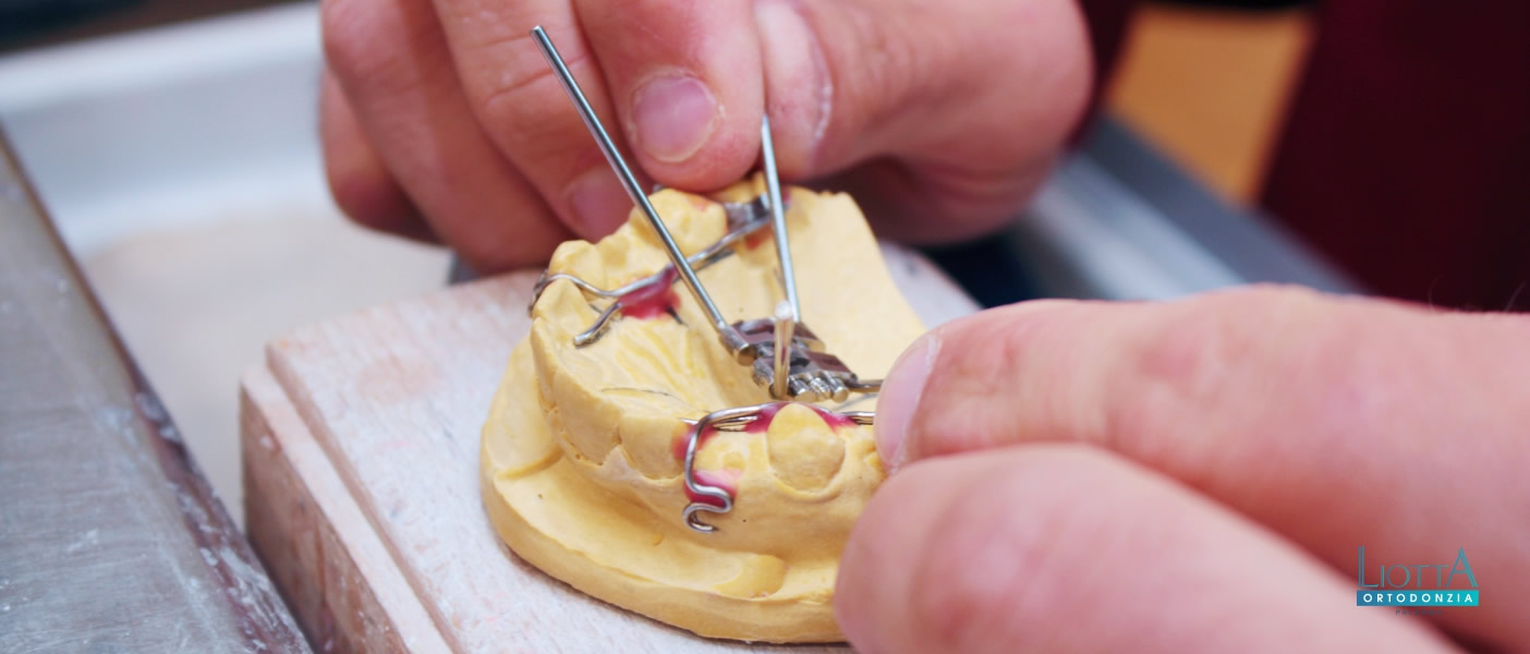Liotta è un laboratorio ortodontico a Palermo altamente specializzato in ortodonzia, per adulti e bambini.