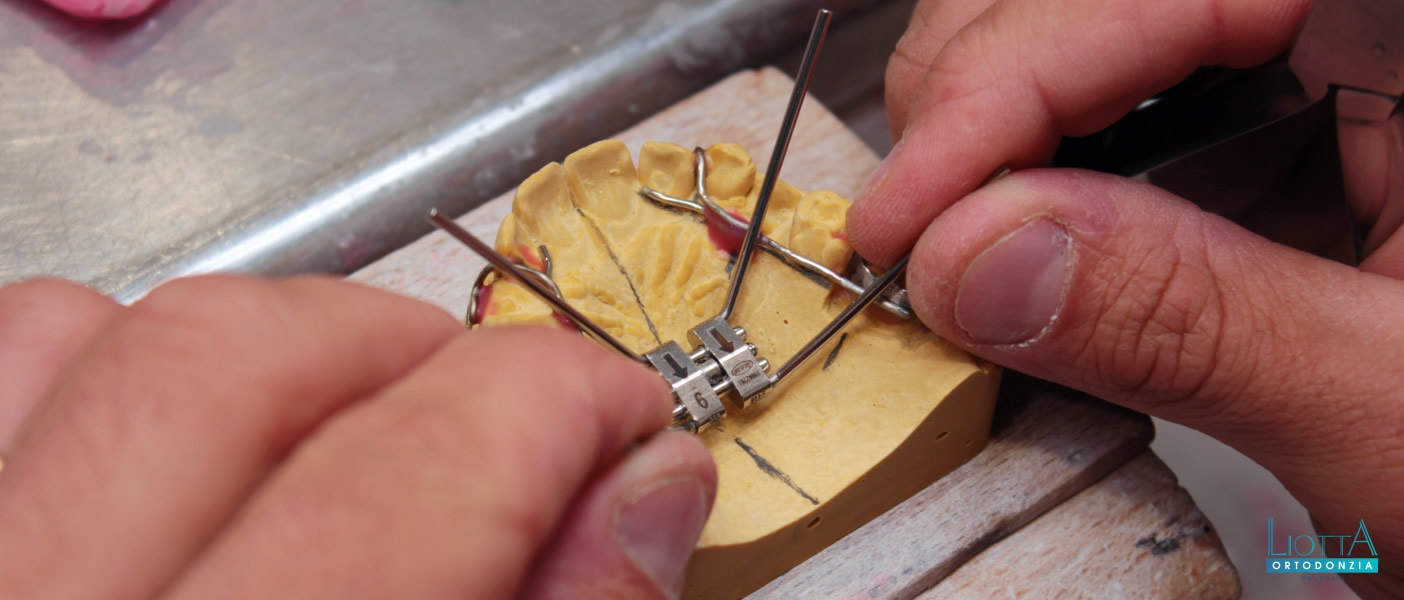 Liotta è un laboratorio ortodontico a Palermo altamente specializzato in ortodonzia, per adulti e bambini.