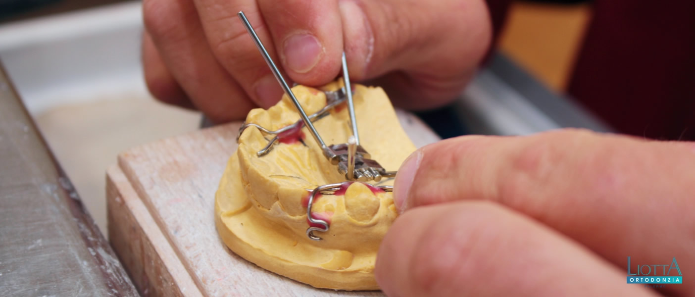Liotta è un laboratorio ortodontico a Palermo altamente specializzato in ortodonzia, per adulti e bambini.