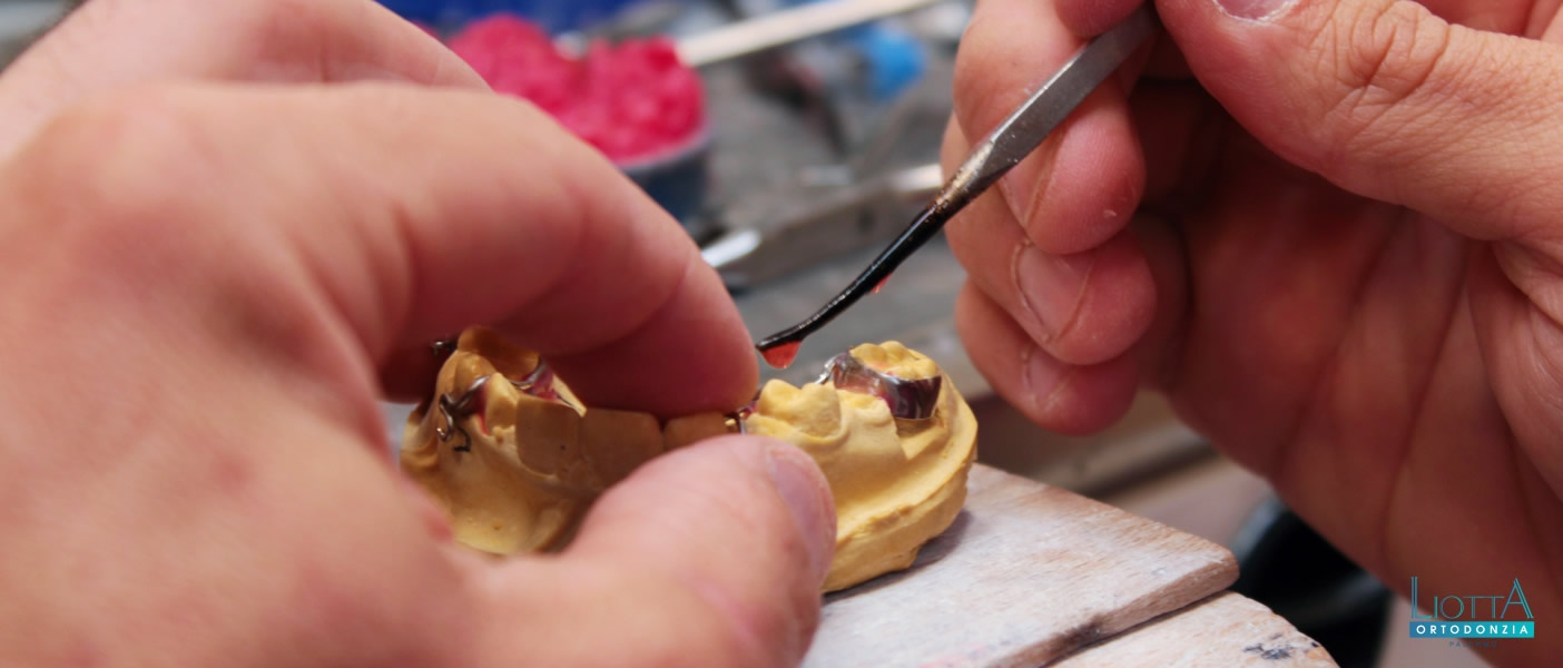 Liotta è un laboratorio ortodontico a Palermo altamente specializzato in ortodonzia, per adulti e bambini.